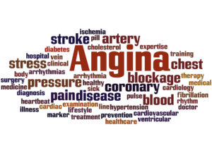 Stable Angina