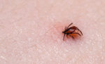 Lyme disease