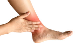 sprain strain