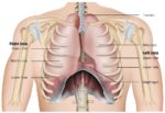 chest cavity